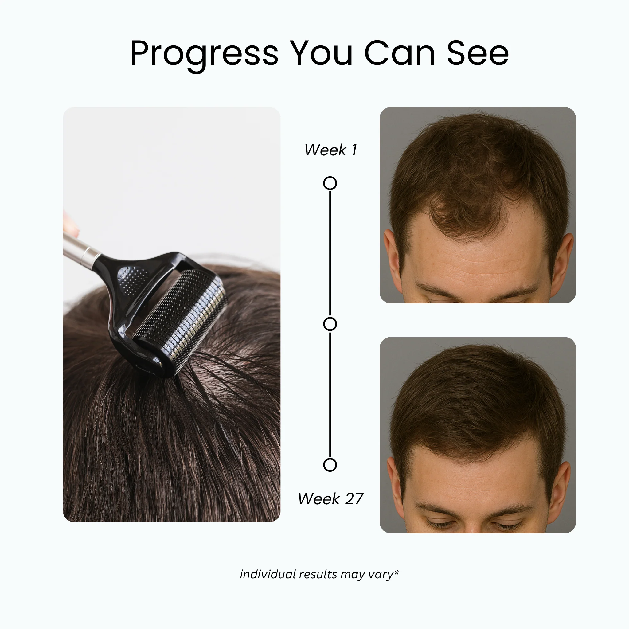 100% Natural Growth Duo™ - Image 4