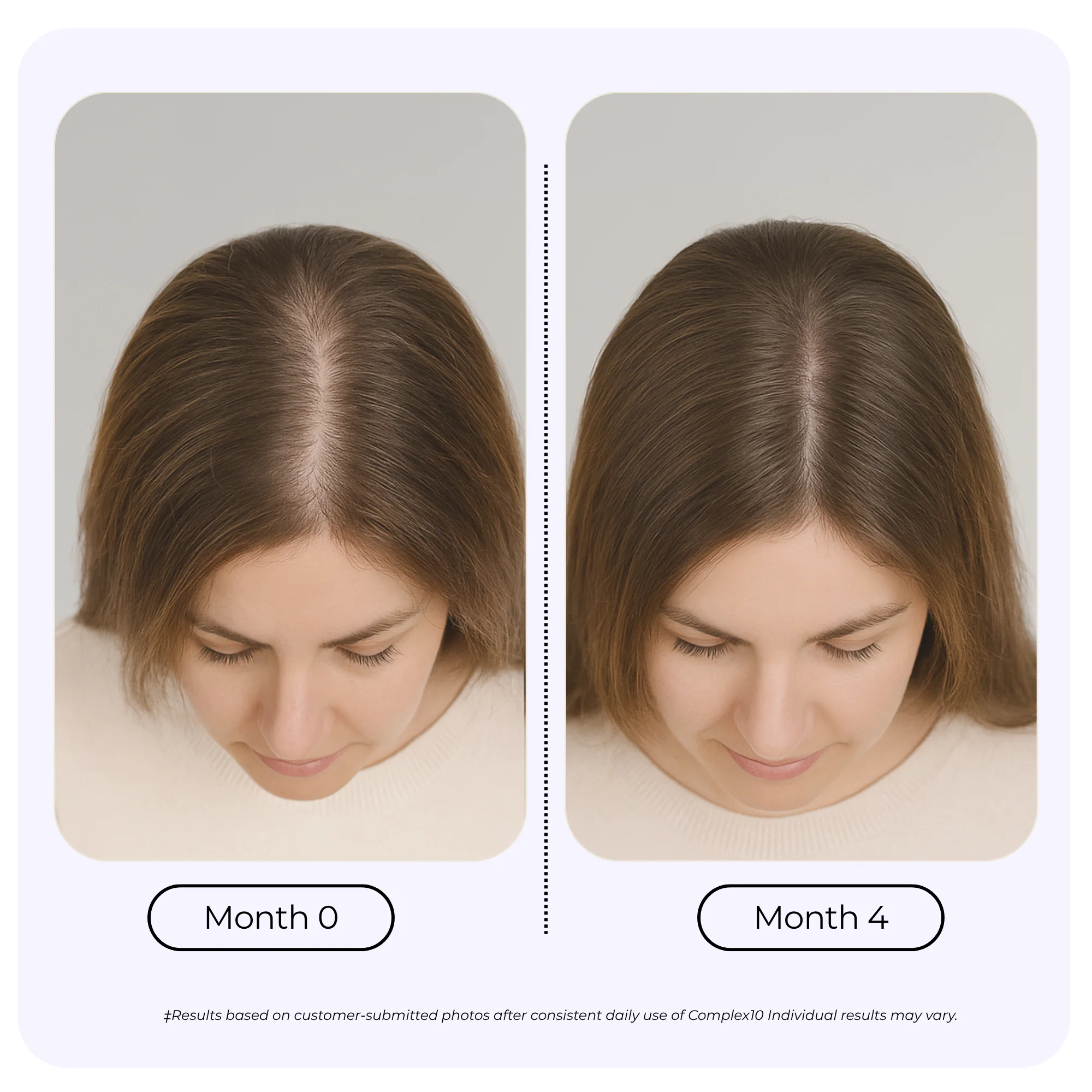 Complex10™ Hair Growth Supplement - Image 4