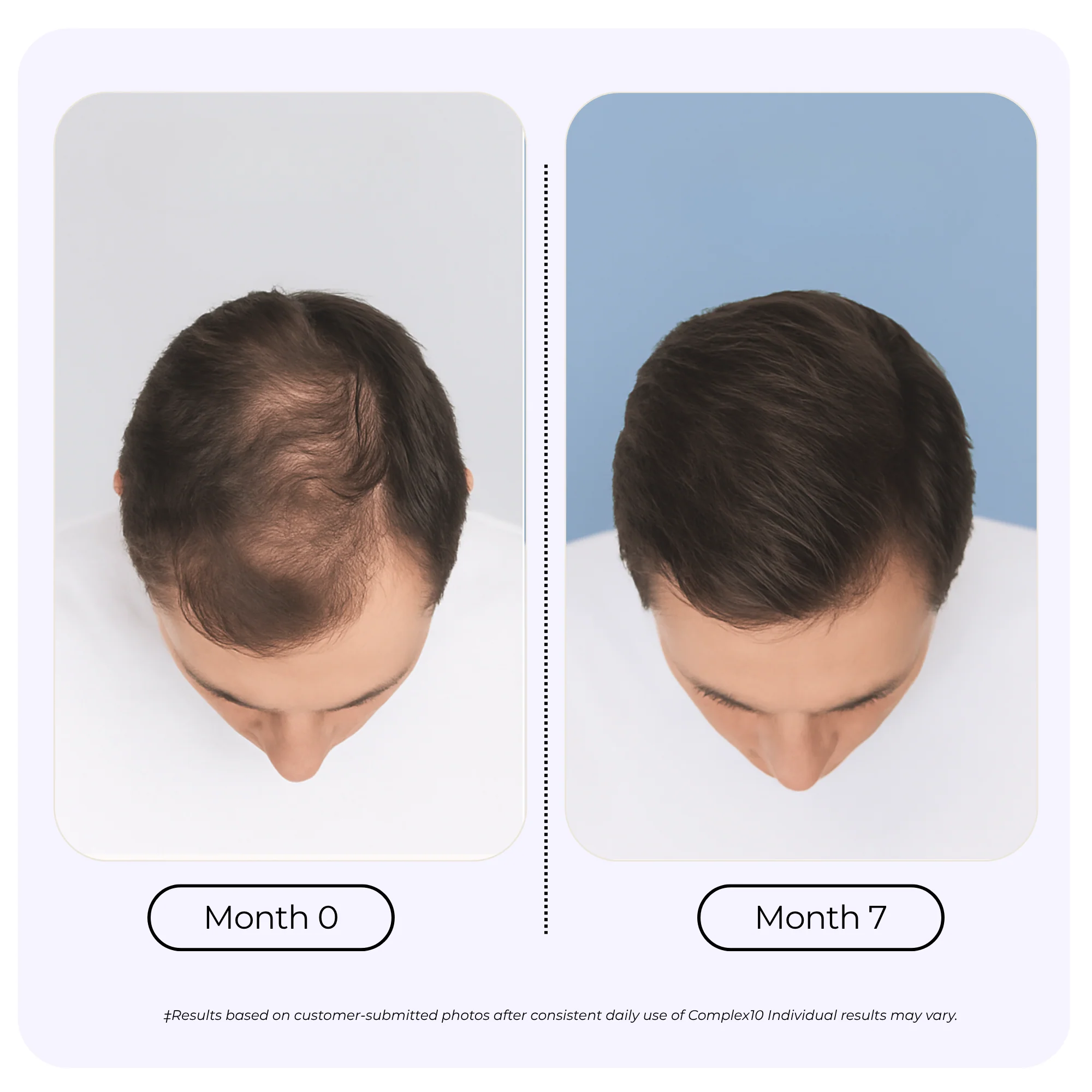 Complex10™ Hair Growth Supplement - Image 5