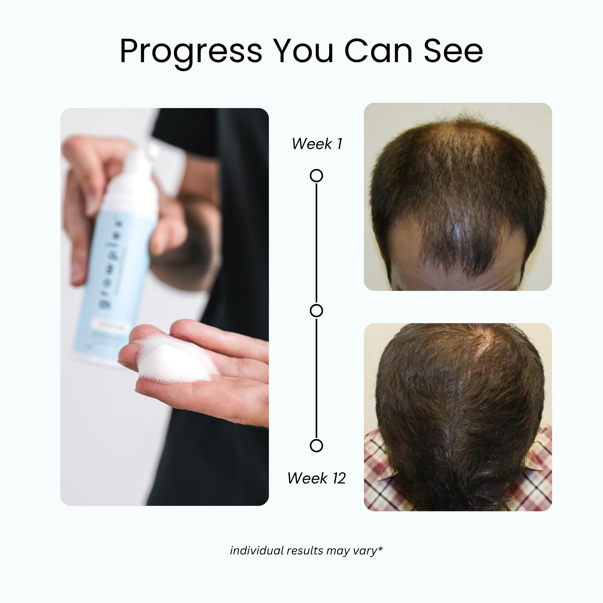 Full Regrowth Kit™ - Image 3