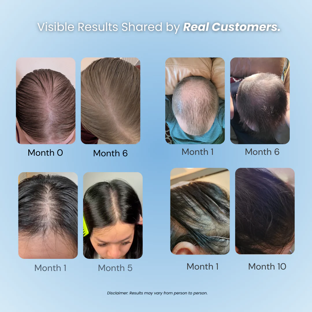 Hair Loss Prevention Kit - Image 3