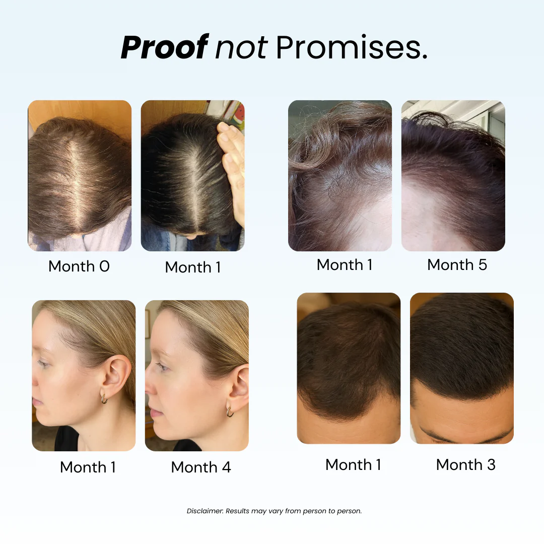 Replenish™ Conditioner – Hydrate & Grow - Image 3