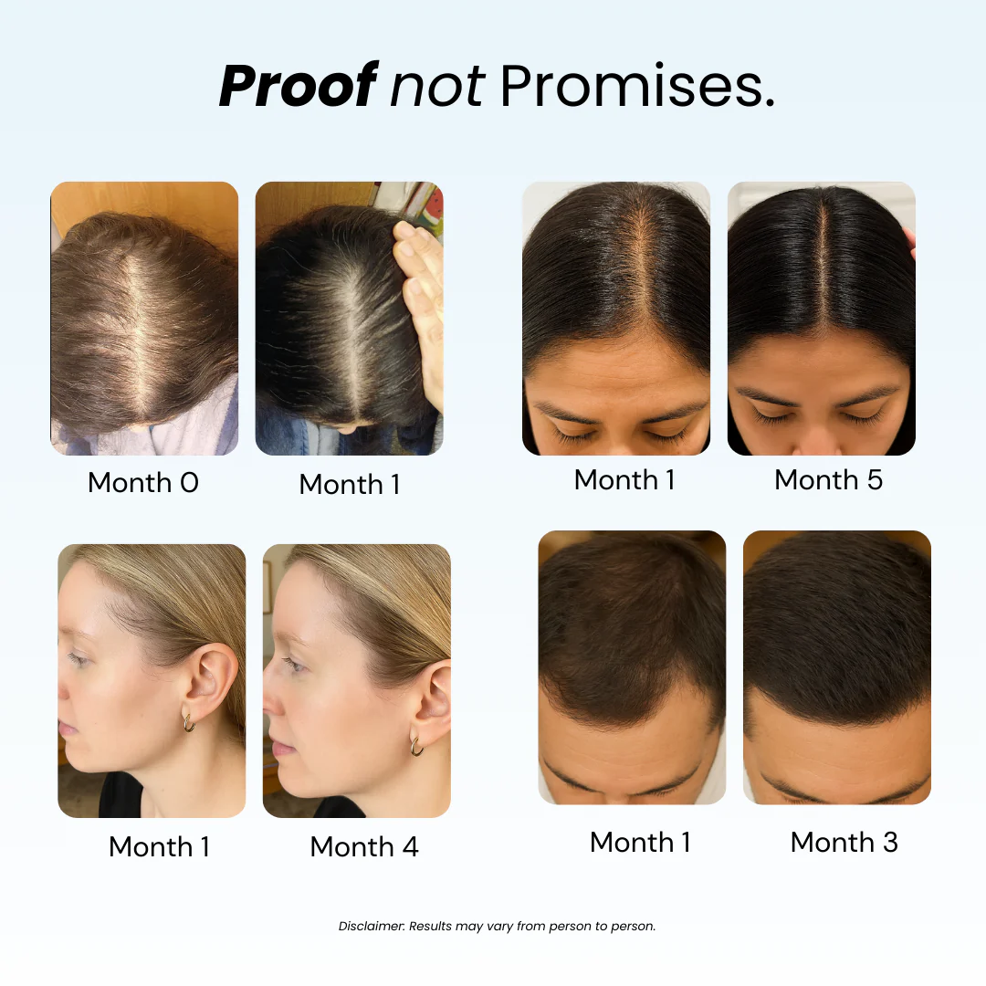 Revive™ Hair Growth Shampoo – Strengthen & Nourish - Image 3