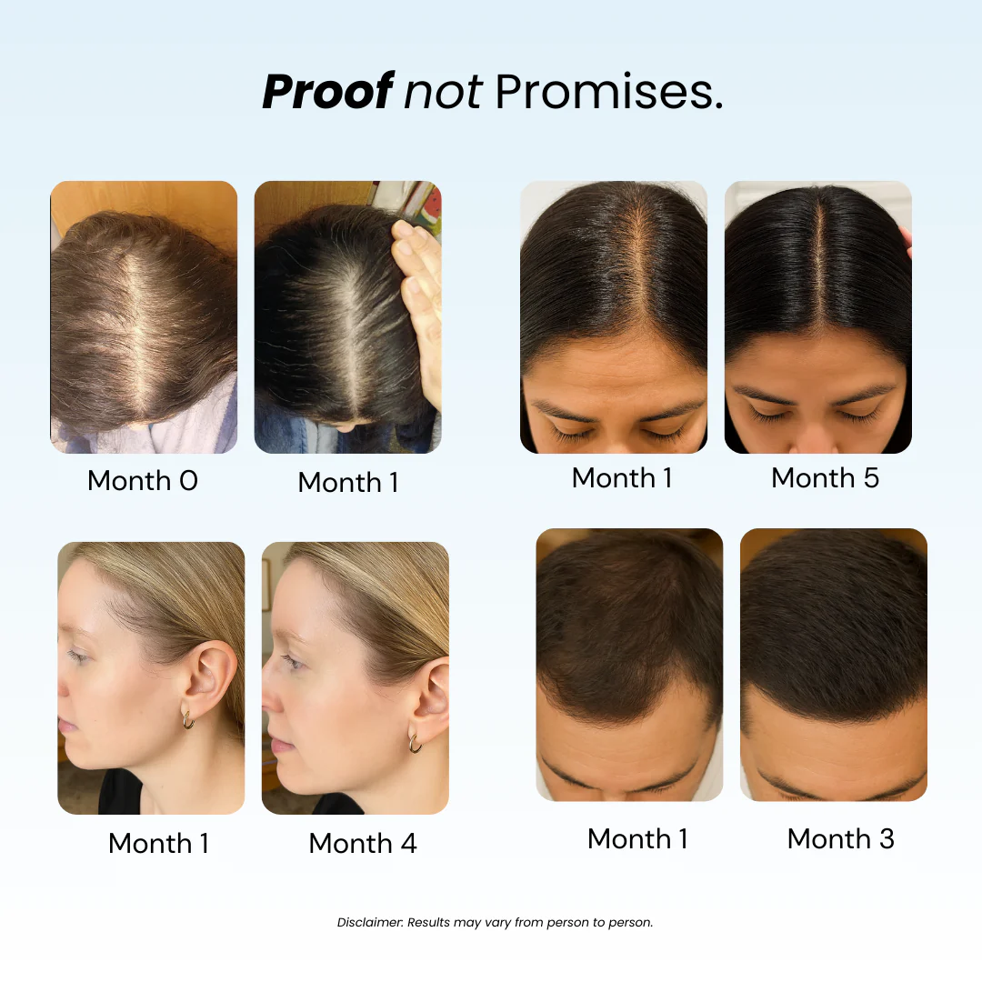 Revive™ & Replenish™ - Hair Growth Shampoo and Conditioner - Image 3