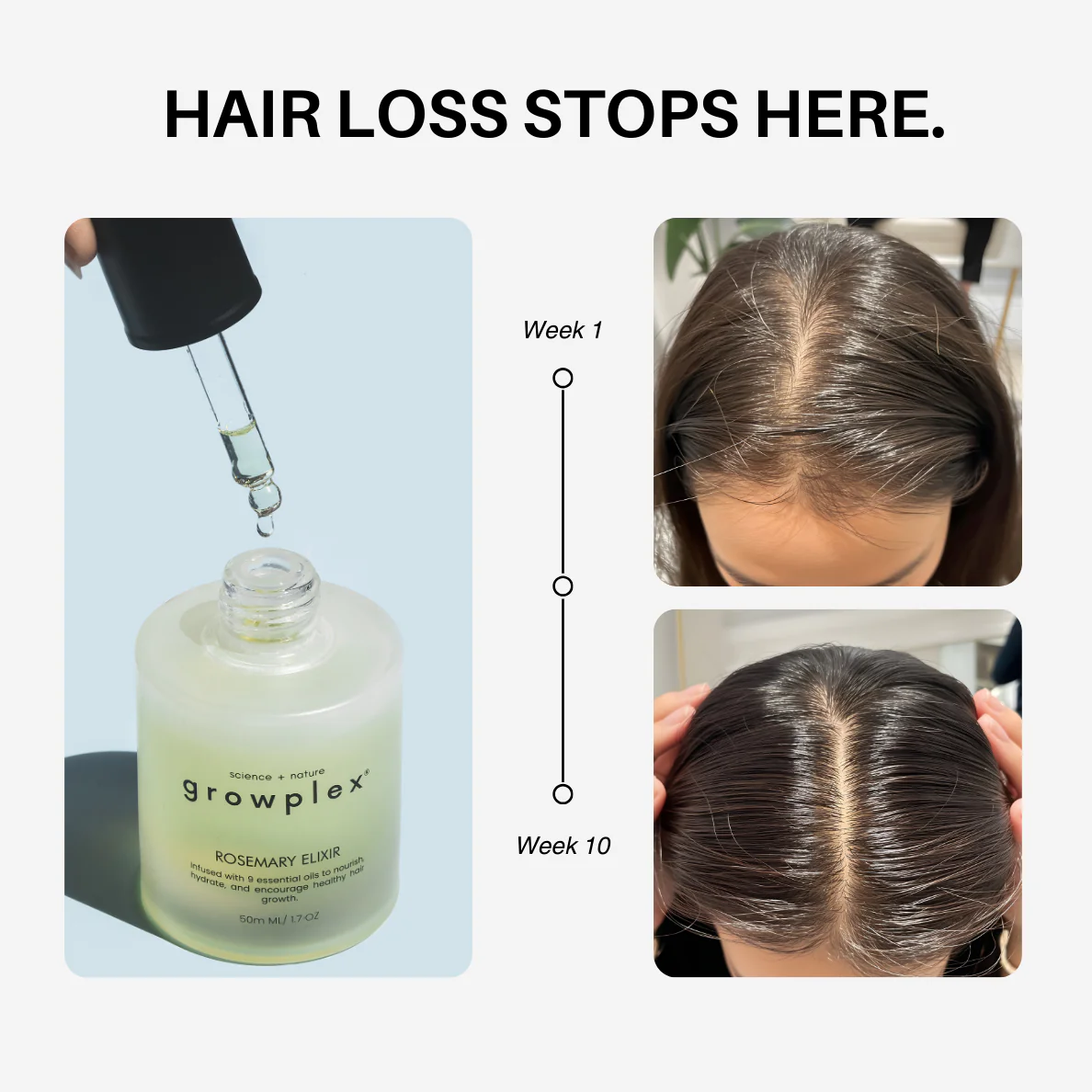 Rosemary Elixir - 100% Natural Hair Loss Solution - Image 3