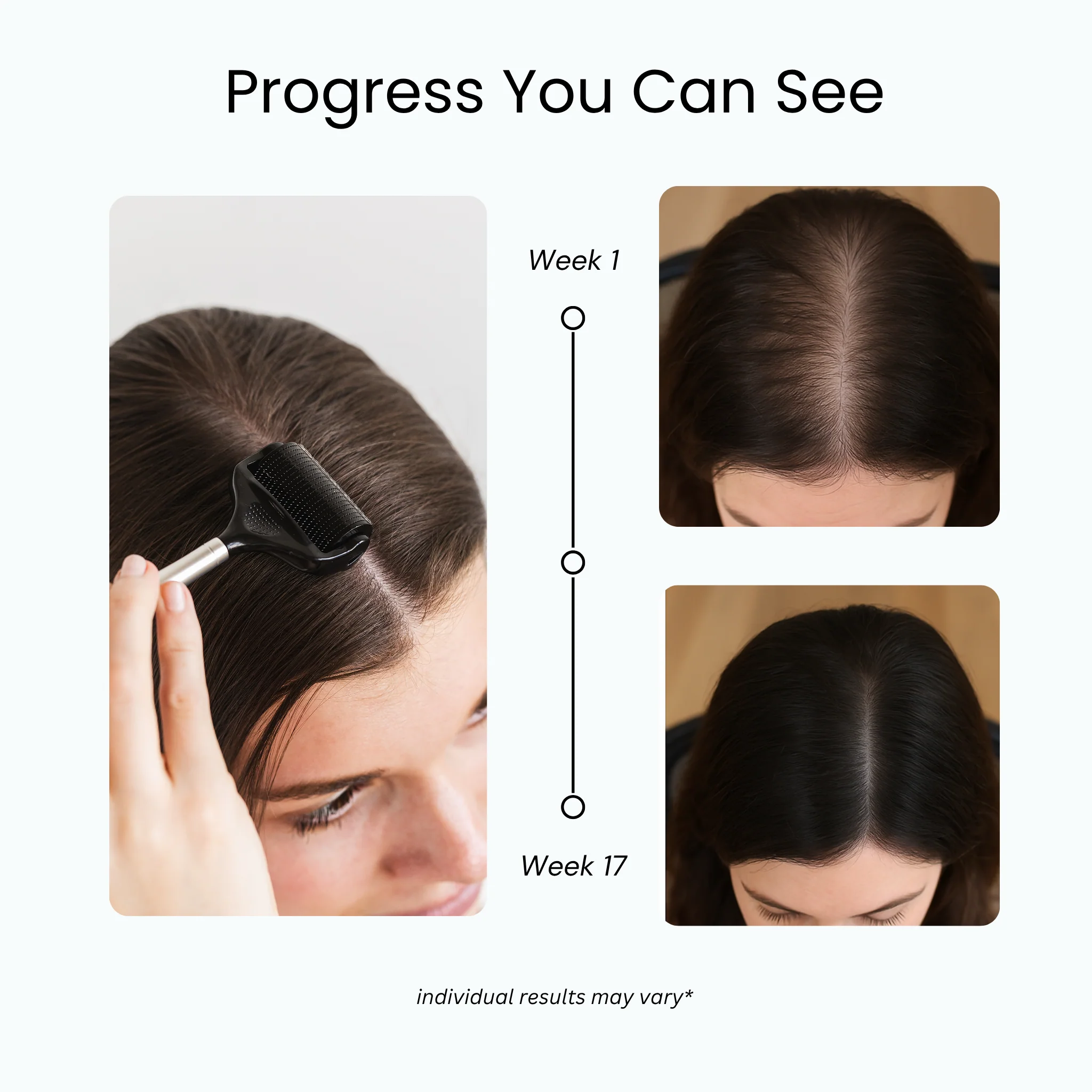 Full Regrowth Kit™ - Image 4