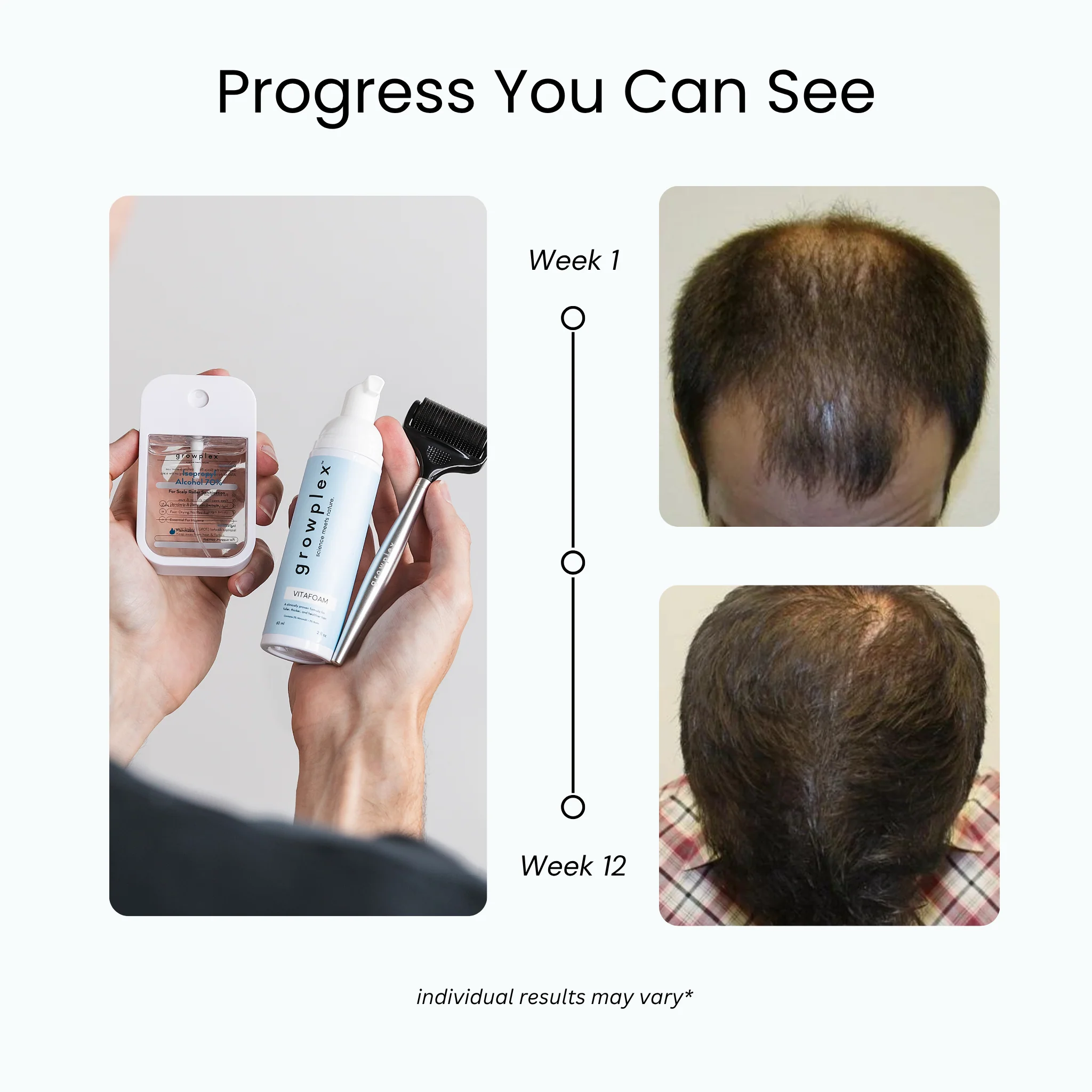 The 3X Growth Kit™ - Image 4